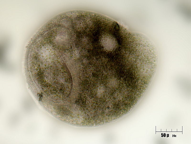 Stentor in forma libera