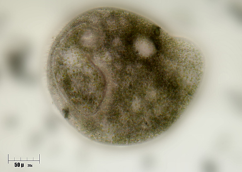 Stentor in forma libera