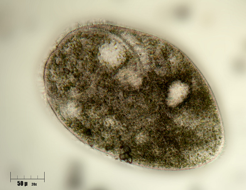 Stentor in forma libera