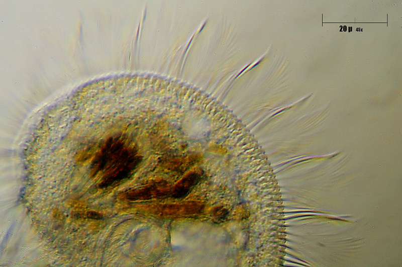 Stentor sp. vagante