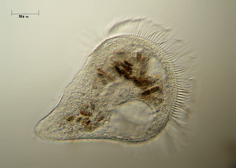 Stentor sp. vagante