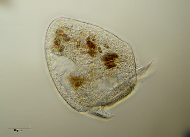 Stentor sp. vagante