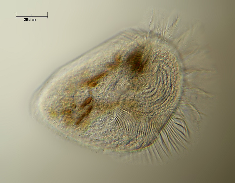 Stentor sp. vagante