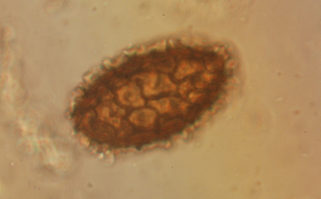 Tuber macrosporum