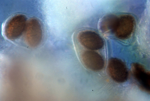 Prove  di microscopia