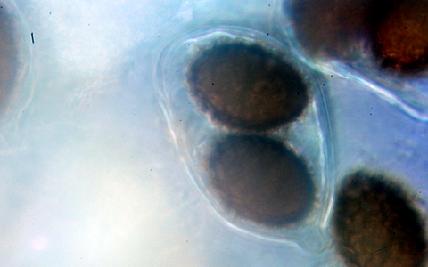 Prove  di microscopia