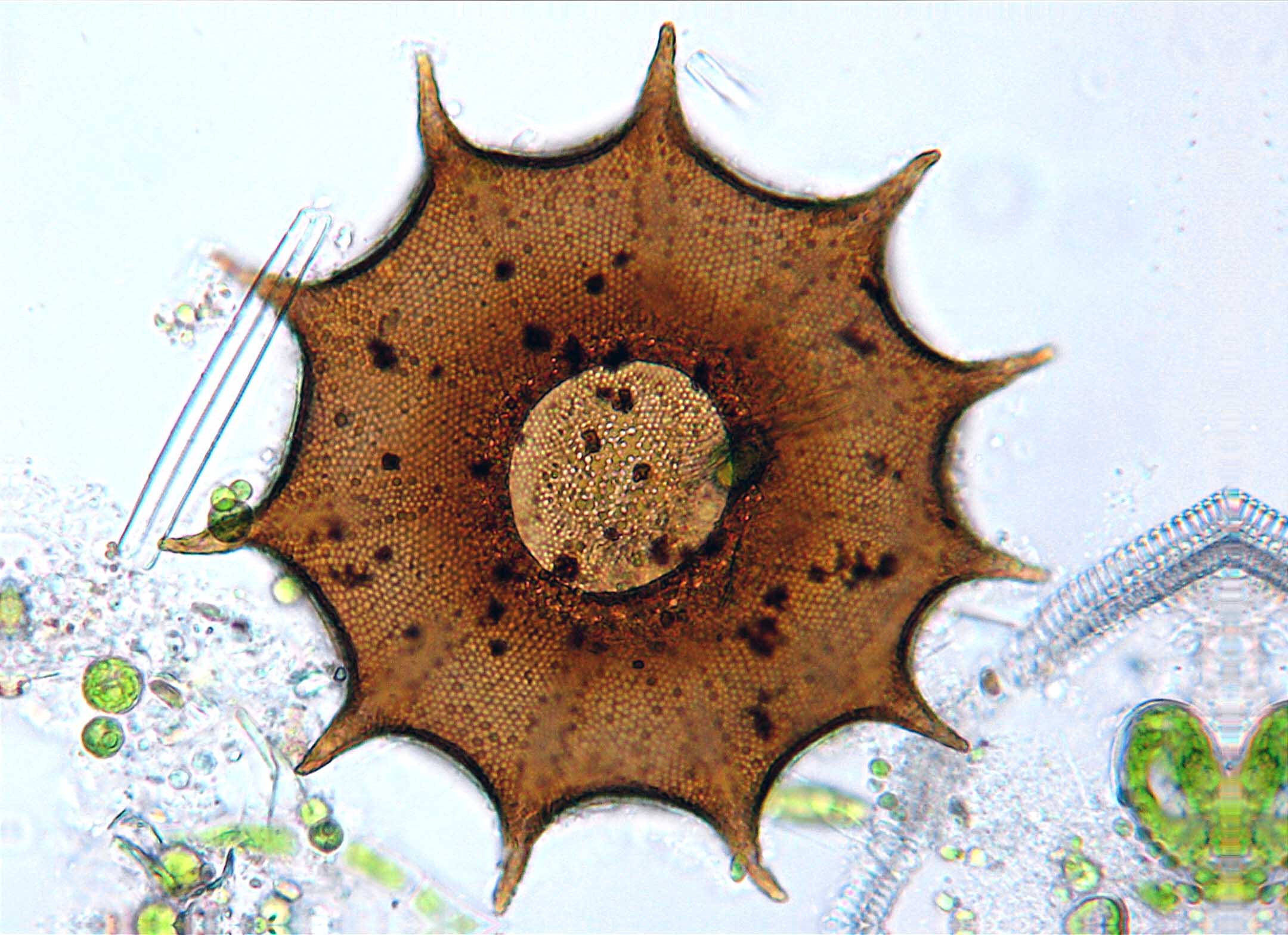 Arcella Dentata