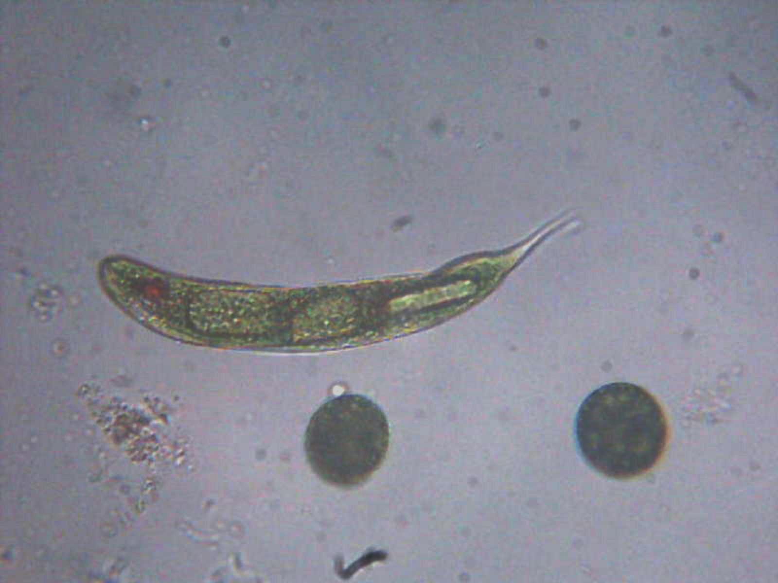 Euglena?