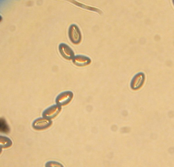 Inocybe sp.  fra gli aghi di Pinus halepensis