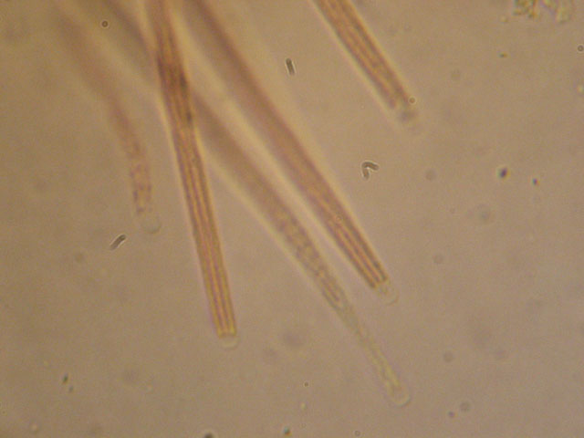 Le Cordyceps