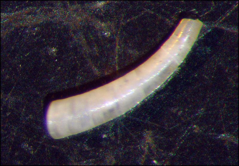 caecum?