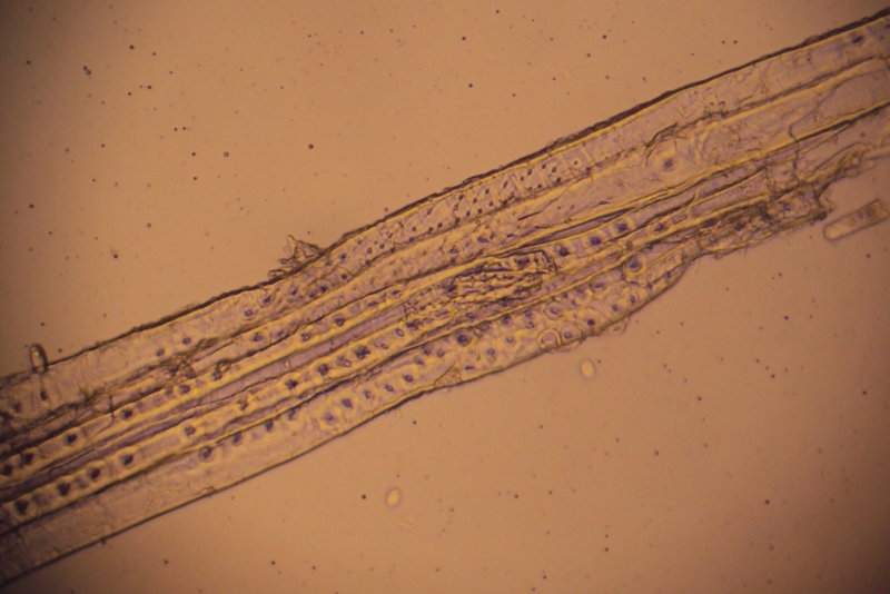 Ed io cosa sono? (Sarcoscypha)