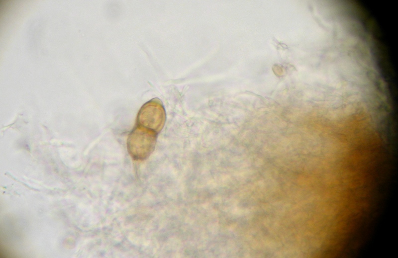 Micro di Ganoderma resinaceum