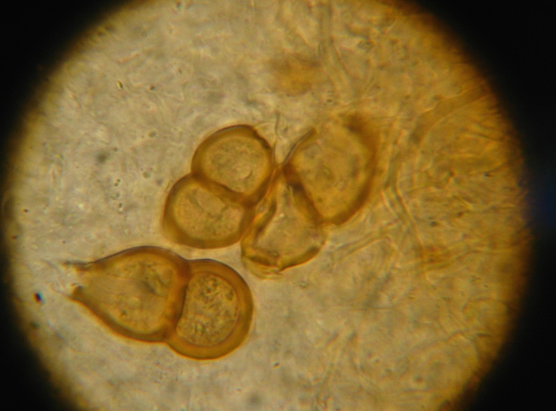 Micro di Ganoderma resinaceum