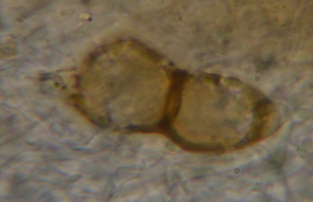 Micro di Ganoderma resinaceum