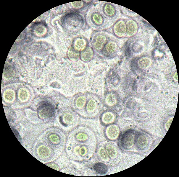 Da determinare. Paret de Canalda - Solson�s - Catalonia