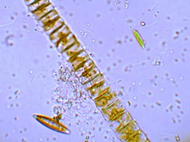 (2) Prime immagini al microscopio: batteri-protozoi-diatomee
