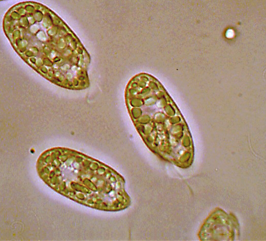 (4) Prime immagini al microscopio: batteri-protozoi-diatomee