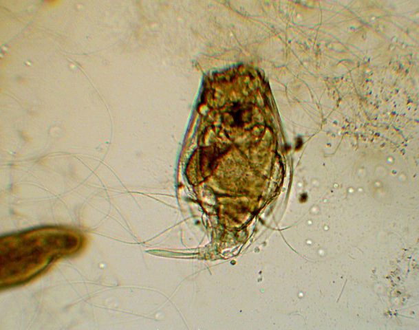 Prime immagini al microscopio: batteri - protozoi - diatomee