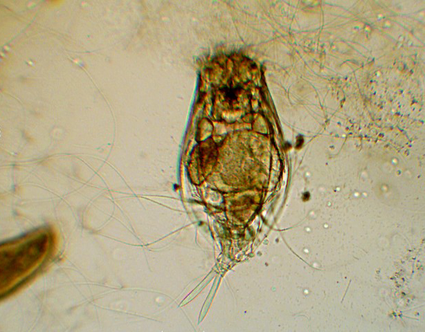 Prime immagini al microscopio: batteri - protozoi - diatomee