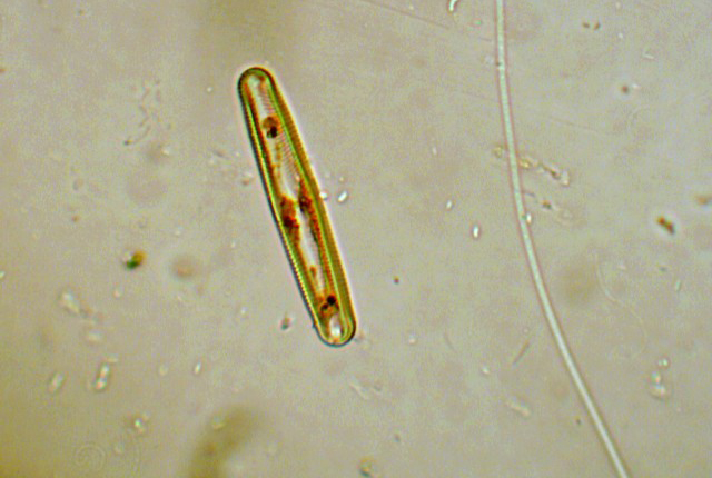 (2) Prime immagini al microscopio: batteri-protozoi-diatomee