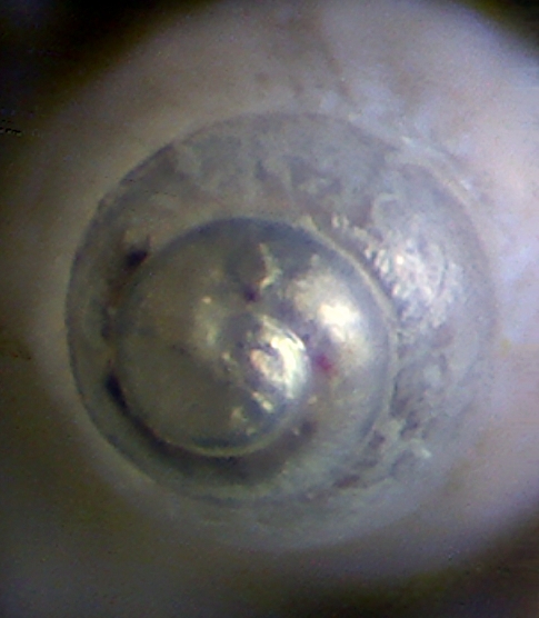 Bathriphallus  o Odostomia nitens ?