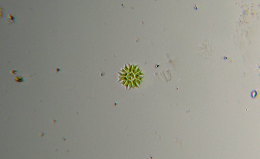 Vari Pediastrum