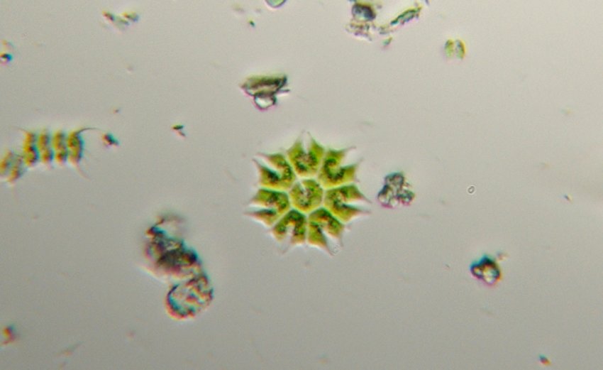 Vari Pediastrum