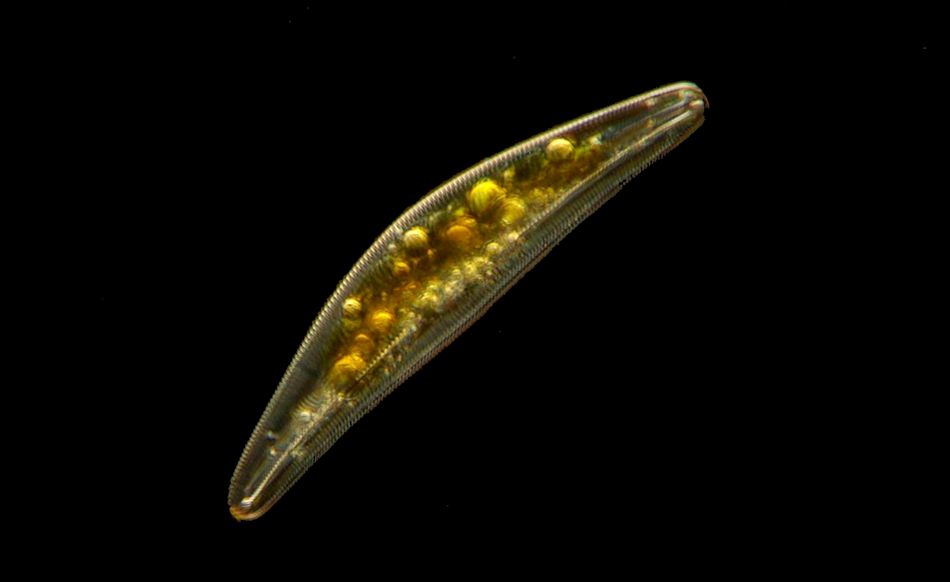 Cimbella campo scuro [ Cymbella sp. ]