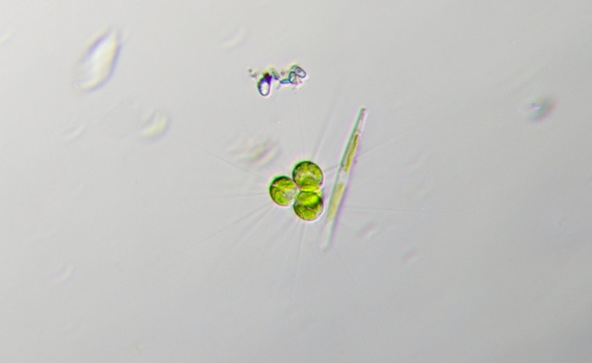Micractinium