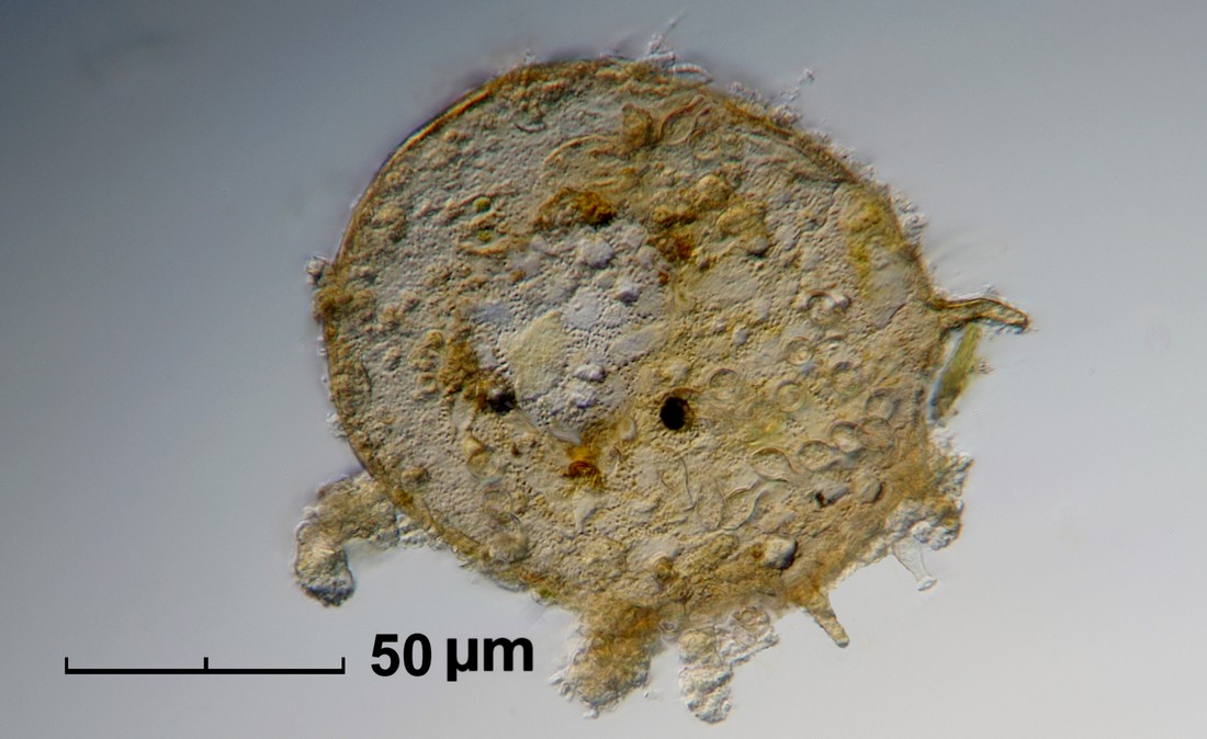 Arcelle dentate o semi dentate