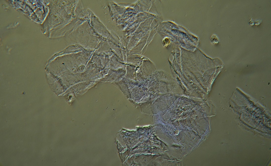 MISSIONE COMPIUTA !! - MICROSCOPIO ACQUISTATO