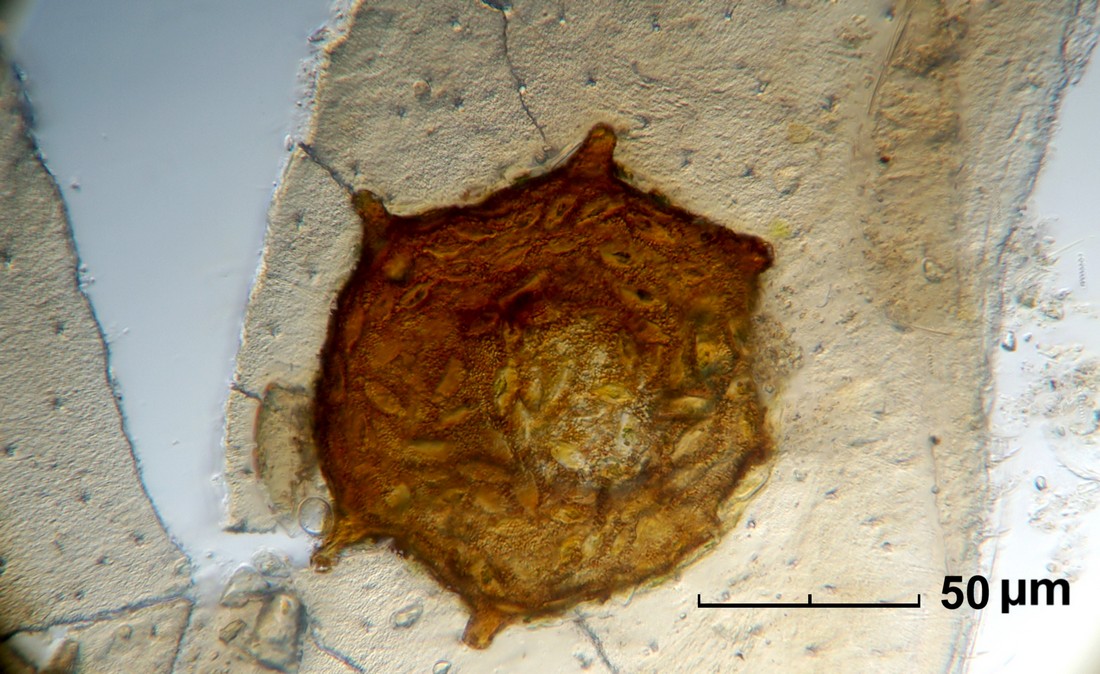 Arcelle dentate o semi dentate