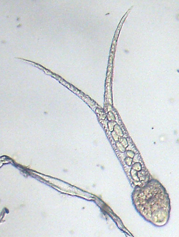 Trichobilharzia sp.