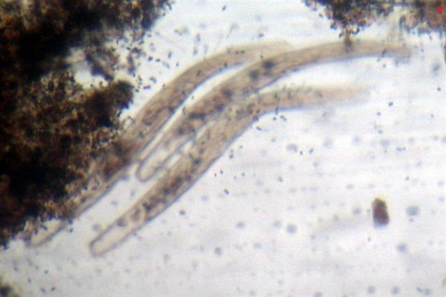 Trichobilharzia sp.