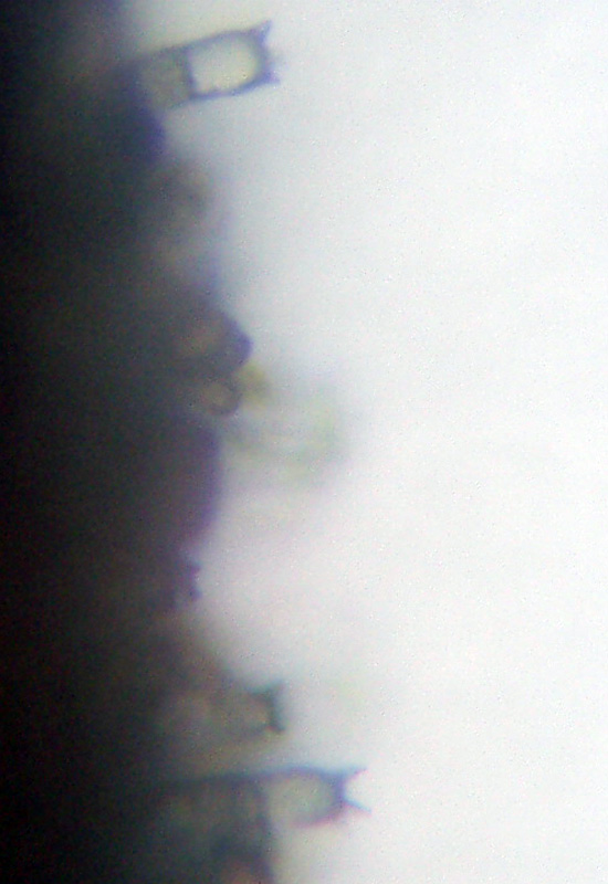 Microscopia sospetta Coniophora puteana (Coniophora puteana)