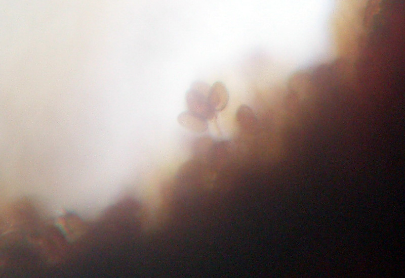 Microscopia sospetta Coniophora puteana (Coniophora puteana)