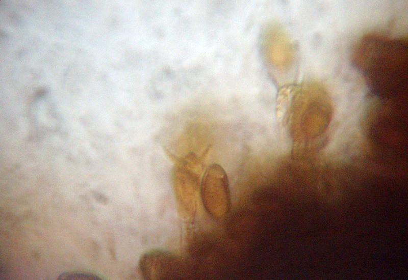 Microscopia sospetta Coniophora puteana (Coniophora puteana)