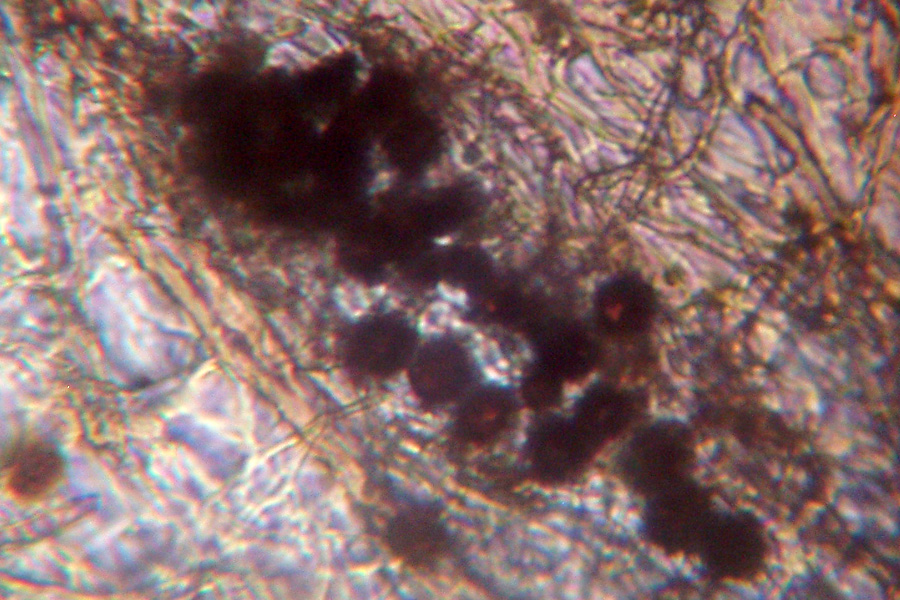 Ganoderma: serve la micro?