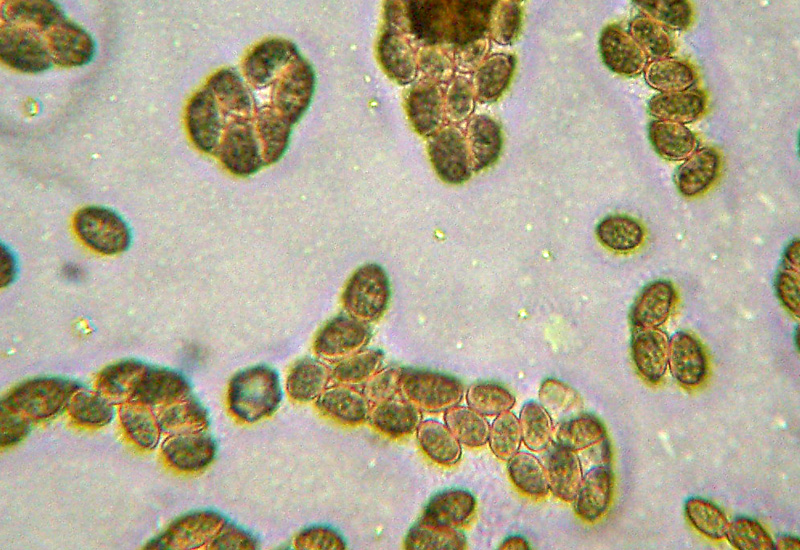 Microscopia sospetta Coniophora puteana (Coniophora puteana)