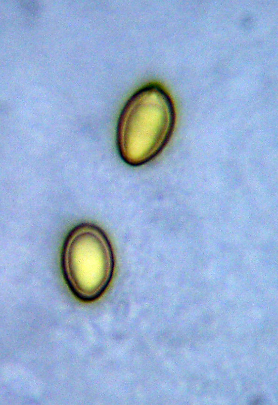 Microscopia sospetta Coniophora puteana (Coniophora puteana)