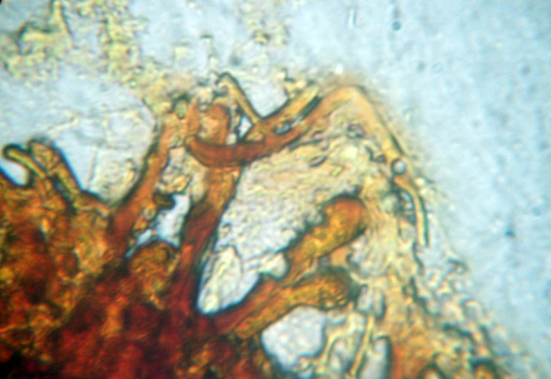 Microscopia sospetta Coniophora puteana (Coniophora puteana)