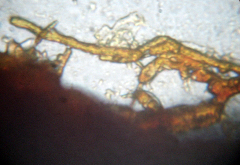 Microscopia sospetta Coniophora puteana (Coniophora puteana)