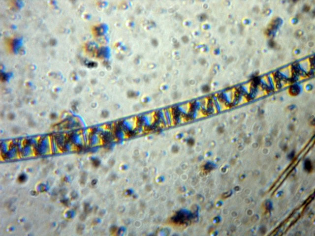 Spirogyra sp.