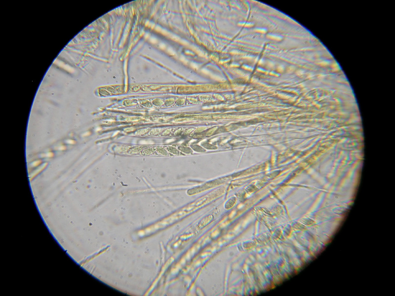 Sclerotunia sclerotiorum