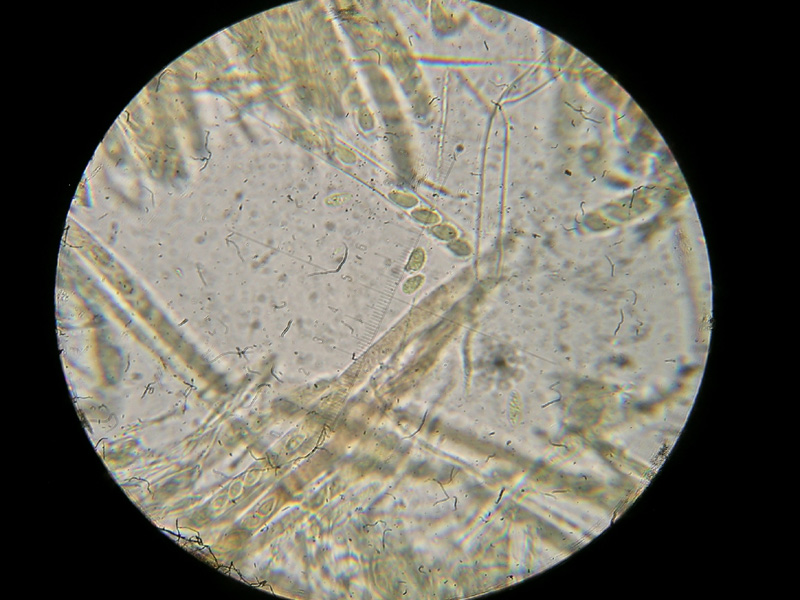 Sclerotunia sclerotiorum