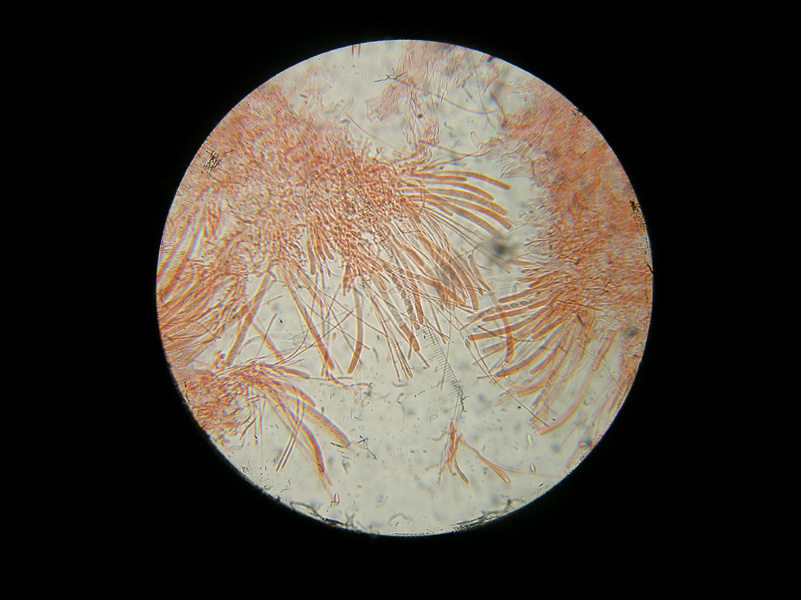 Sclerotunia sclerotiorum