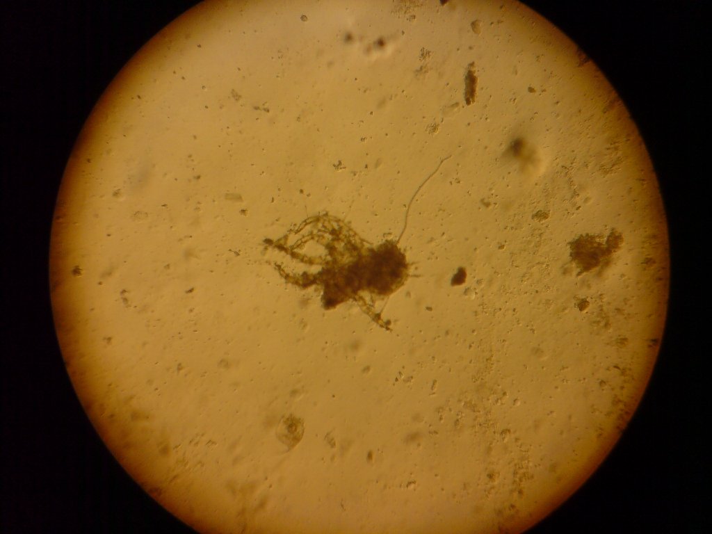 Identificazione artropode?