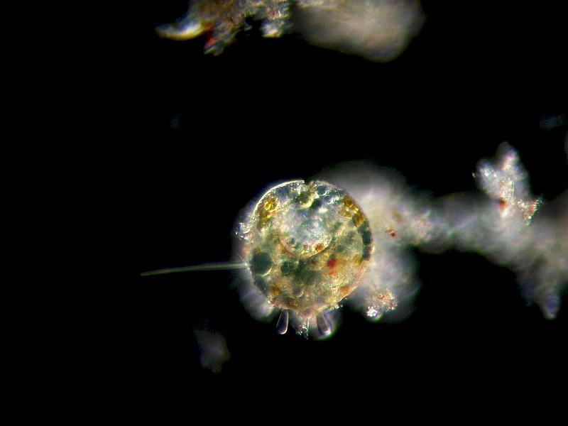 Centropyxis aculeata