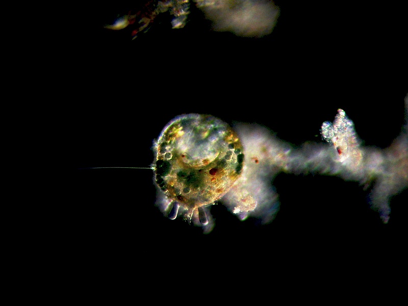 Centropyxis aculeata